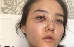 Казахстанский дипломат избивал жену - полиция завела на него уголовное дело 