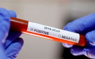 Еще 74 человека заболели коронавирусом в Казахстане за сутки