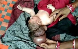 Необычный младенец с тремя головами родился в Индии