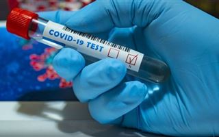 В Казахстане за прошедшие сутки коронавирусом заболели 740 человек