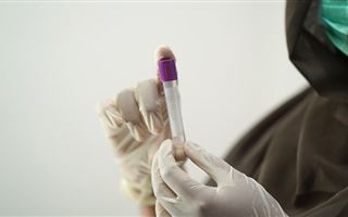 Новый штамм коронавируса EG.5 «находится на подъеме» - глава ВОЗ