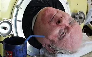 Мужчина 72 года прожил в железной капсуле из-за опасной болезни