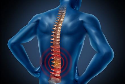 Боль в спине может довести до реанимации - терапевт