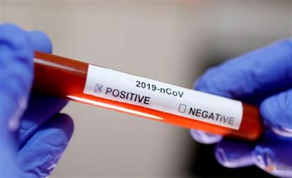 Еще 74 человека заболели коронавирусом в Казахстане за сутки