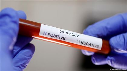 В Казахстане зарегистрировано еще 63 новых случая заболевания коронавирусом