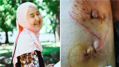 Житель Алматы изрезал ножом бывшую жену и избил няню