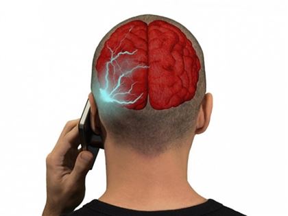 Раскрыта связь между смартфонами и опухолью мозга