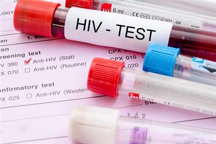 В РК в августе ВИЧ-инфекцией заболели более 190 человек