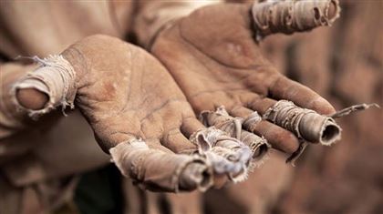 На востоке РК пенсионерка потеряла кисти рук, находясь в рабстве