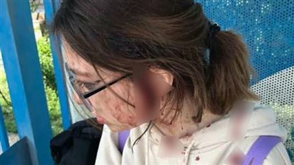 В Алматинской области на остановке две женщины избили несовершеннолетнюю девушку