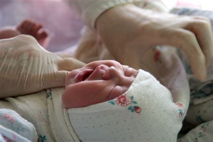 В Казахстане стали чаще рождаться дети с множественными  пороками развития