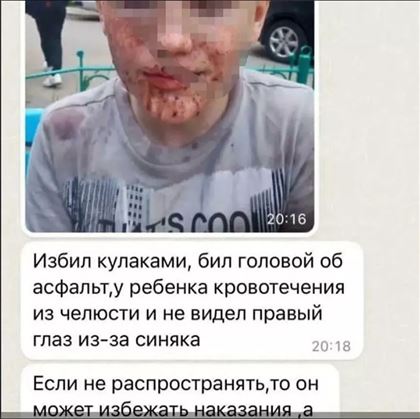 "Мужчина избил мальчика, а затем ударил головой об асфальт" – житель Акмолинской области вмешался в конфликт детей 