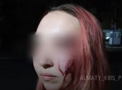 Незнакомый мужчина напал на 28-летнюю алматинку и избил ее