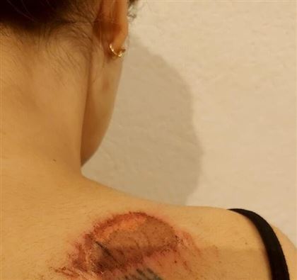 В жестоком избиении обвинила полицейского жительница Шымкента