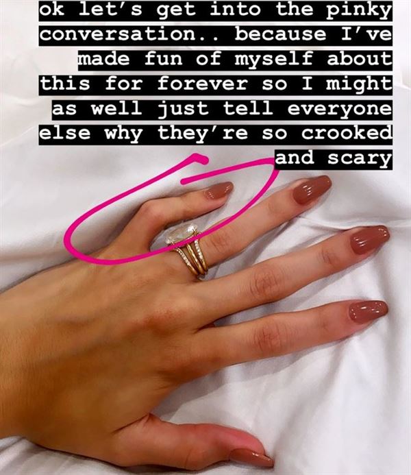 Хейли Бибер объяснила причину «скрюченных» мизинцев instagram.com/haileybieber/
