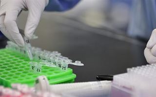 Россия передала странам ЕАЭС и СНГ средства диагностики коронавирусной инфекции