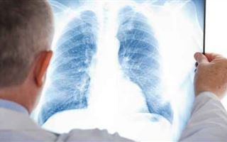 Заболеваемость туберкулезом выросла на 3,1 процента в Казахстане