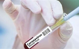 Жителей Усть-Каменогорска начали проверять на коронавирус