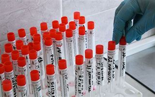 Бекшин озвучил, почему Алматы лидирует в стране по числу выявленных случаев коронавируса