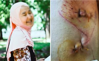 Житель Алматы изрезал ножом бывшую жену и избил няню