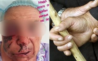 Подробности избиения 79-летней женщины выяснила полиция Алматинской области 