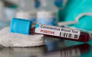 Носители какой группы переносят коронавирус тяжелее всего - исследование