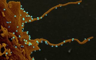 Как коронавирус тянет "зловещие щупальца" к здоровым клеткам