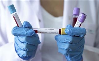 В Казахстане зарегистрировано 230 новых случаев заболевания коронавирусом
