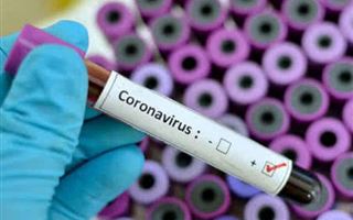 67 заболевших COVID-19 выявлено в РК за прошедшие сутки