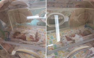 Новорожденных близняшек спасли алматинские врачи