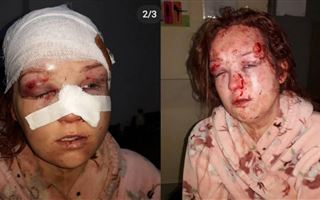 В Шымкенте мужчина жестоко избил бывшую сожительницу молотком во дворе ее дома