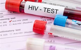 В РК в августе ВИЧ-инфекцией заболели более 190 человек