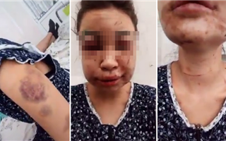 В Павлодаре мужчину обвиняют в похищении и жестоком избиении девушки