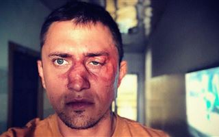 Друг Павла Прилучного рассказал подробности об избиении актера