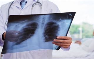 Обновлена статистика по заболеваемости пневмонией в Казахстане