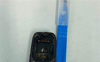 Житель Кызылорды проглотил мобильный телефон