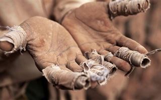 На востоке РК пенсионерка потеряла кисти рук, находясь в рабстве