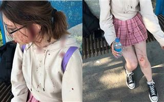 Рассечение и сотрясение мозга: две женщины жестоко избили девочку в Алматинской области