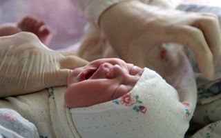 В Казахстане стали чаще рождаться дети с множественными  пороками развития