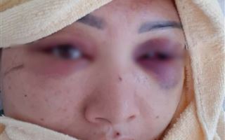 В Кызылорде мужчина избил заболевшую коронавирусом жену и выгнал ее на улицу