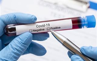 Найден способ предсказать течение коронавирусной инфекции
