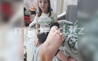 Полмиллиона тенге собрали за три дня казахстанцы на лечение девочки из Уральска