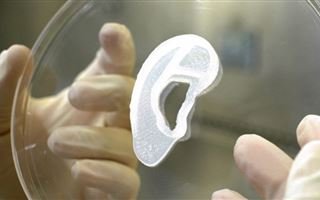 В США пациентке пересадили напечатанное на 3D-принтере ухо