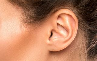 Женщине напечатали выращенное из ее клеток ухо
