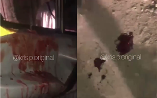 "Вся в крови" - в Казнет попало видео погони за каретой скорой помощи