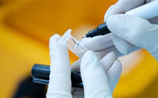 В Казахстане за сутки коронавирусом заболели 154 человека