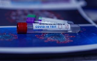 В РК за прошедшие сутки коронавирусом заболели 50 человек