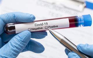 В Казахстане за прошедшие сутки коронавирусом заболели 17 человек