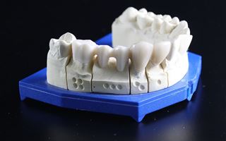 Может ли установка зубных протезов спасти от старческого слабоумия