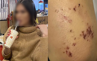 Известного трансвестита обвиняют в том, что он откусил часть уха женщине в Алматы